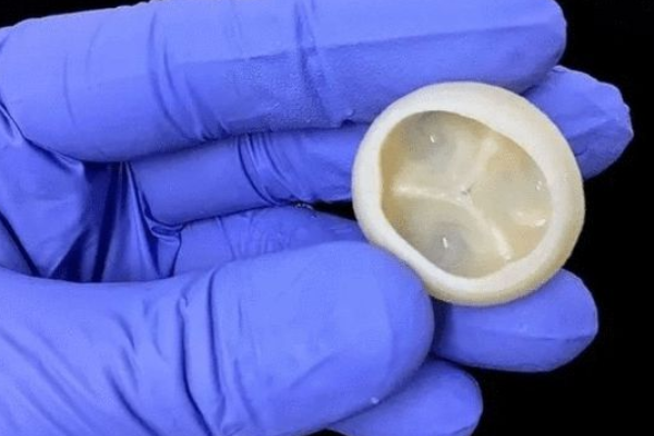【3d打印的器官能用吗】医学奇迹！探索3D打印器官的应用与挑战