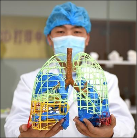 3d打印影像技术与peek材料在医学领域的应用