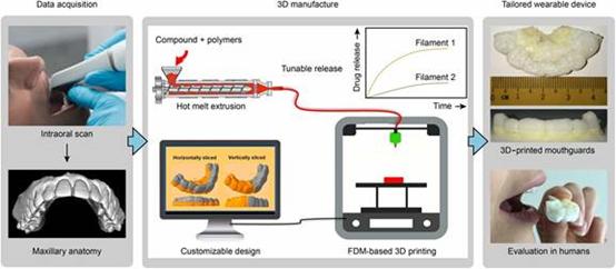 Science Advances｜3D打印个性化可穿戴口腔给药装置