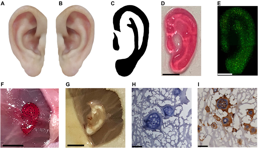 四川大学等使用近红外光3D打印技术在体内制造人类耳朵