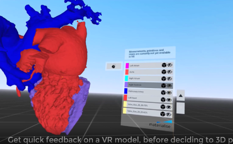 Materialize将VR集成到Mimics软件，3D解剖模型效果更棒！