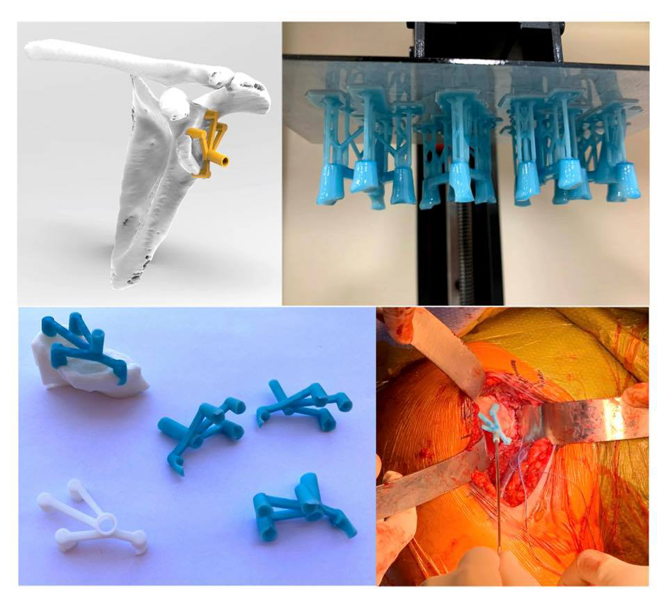 Copper3D即将推出新型抗病毒及生物相容性3D打印树脂：Glaciarys AR3