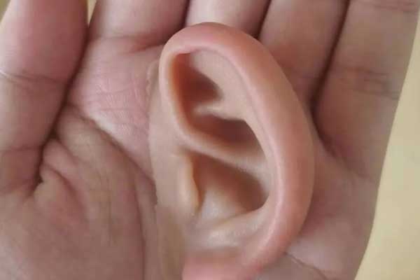 探索未来医疗领域：3D打印技术赋能耳朵再生