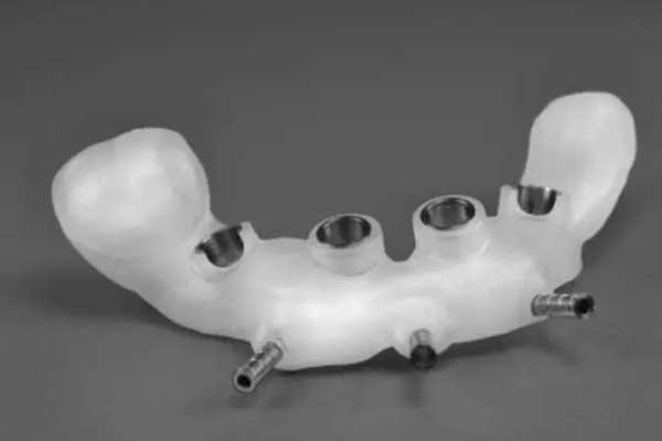 【3d打印种植牙】3D打印技术助力种植牙：现代口腔医学的突破与创新