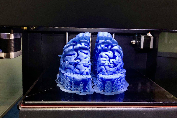 3D打印技术在医疗领域的革新应用与前景展望