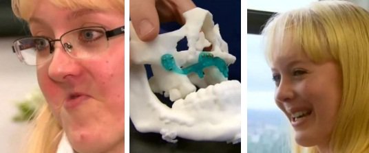 极光尔沃：2018年 3D打印技术至少创造五项医疗奇迹