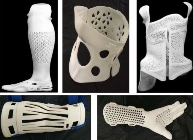 3d printed orthosis_No.9 hospital 3