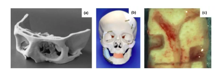 深度解析：3D打印骨组织工程支架研究