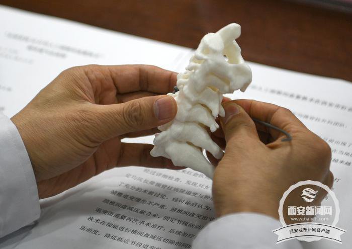 全球首例3D打印人工颈椎间盘置换术助其恢复行走
