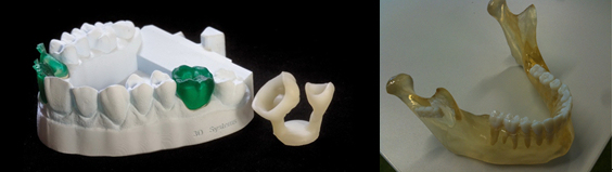 撒罗满3D打印光固化齿科的应用