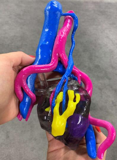 3D-printed kidney model