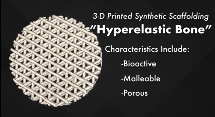  3D打印的Hyperelastic Bone脚手架