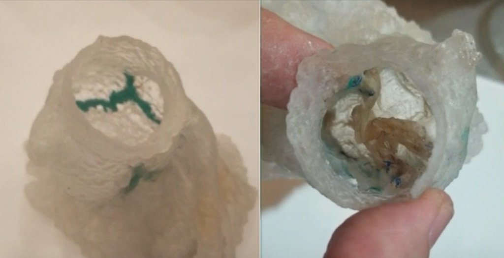  3D打印的主动脉瓣模型