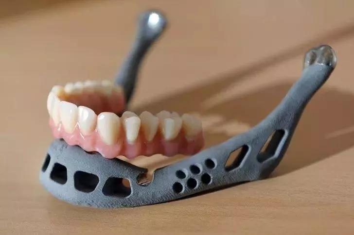 牙齿和下颌植入物，可以打印出精度很高的成品