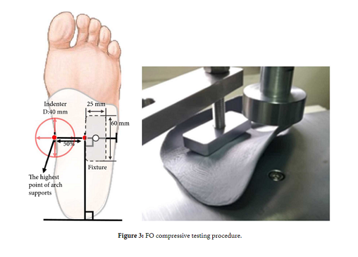 评估3D打印足矫形器对扁平足患者的重要性